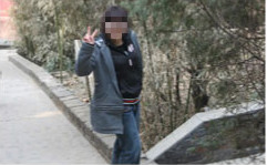 河北侯女士，巧克力囊肿，彻底治愈
